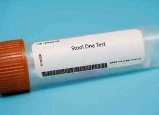 Reducing Post-Polypectomy Colonoscopies with Molecular Stool Testing news-21102024-233122