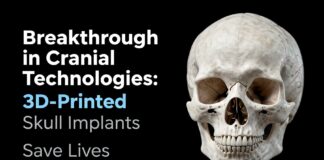 Breakthrough in Cranial Technologies: 3D-Printed Skull Implants Save Lives